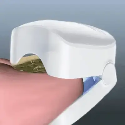 ClearNail Pro™ Nail Fungus Laser Device - Image 6